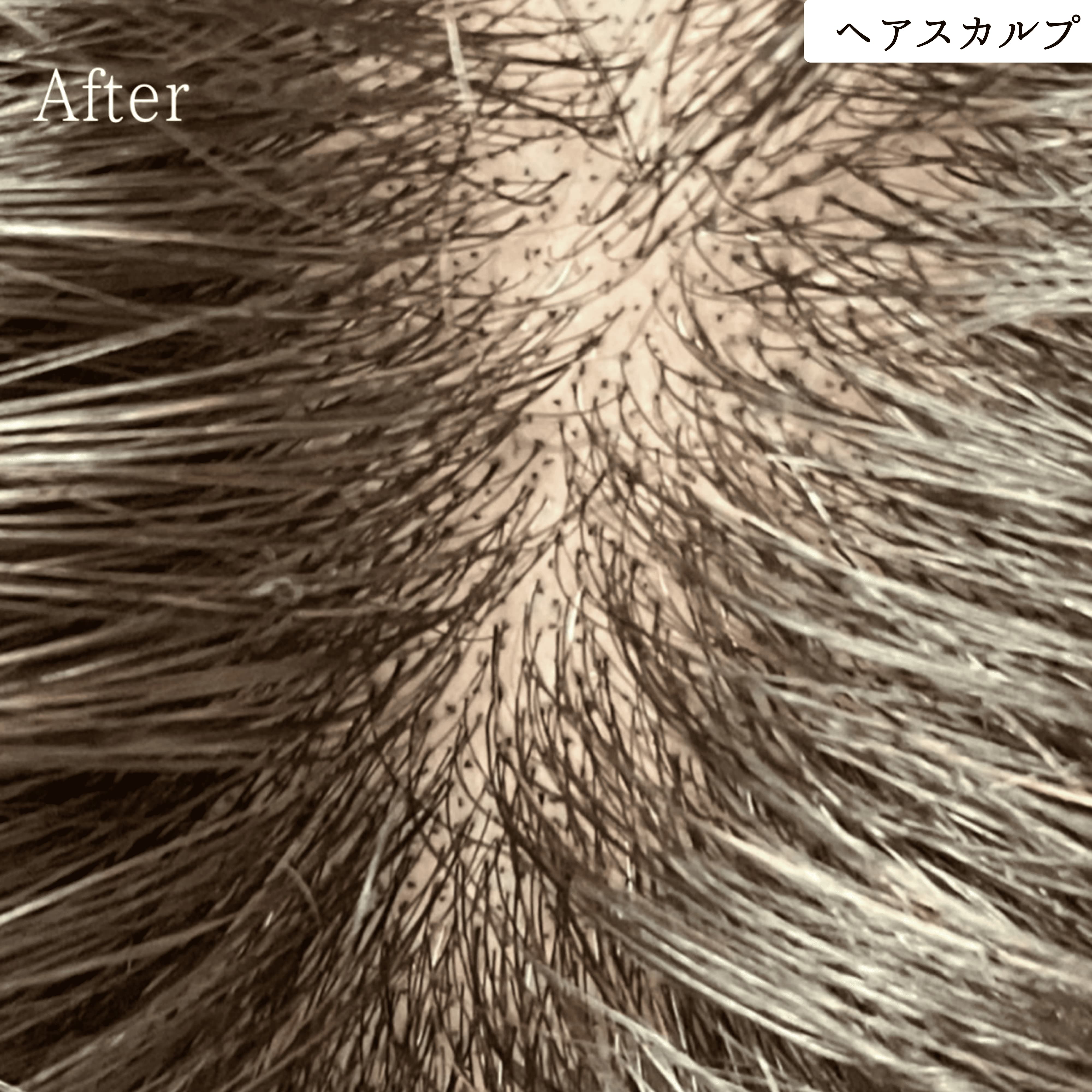 ヘアスカルプメディカルアートメイク 症例 ビフォーアフター｜東京・半蔵門 komi