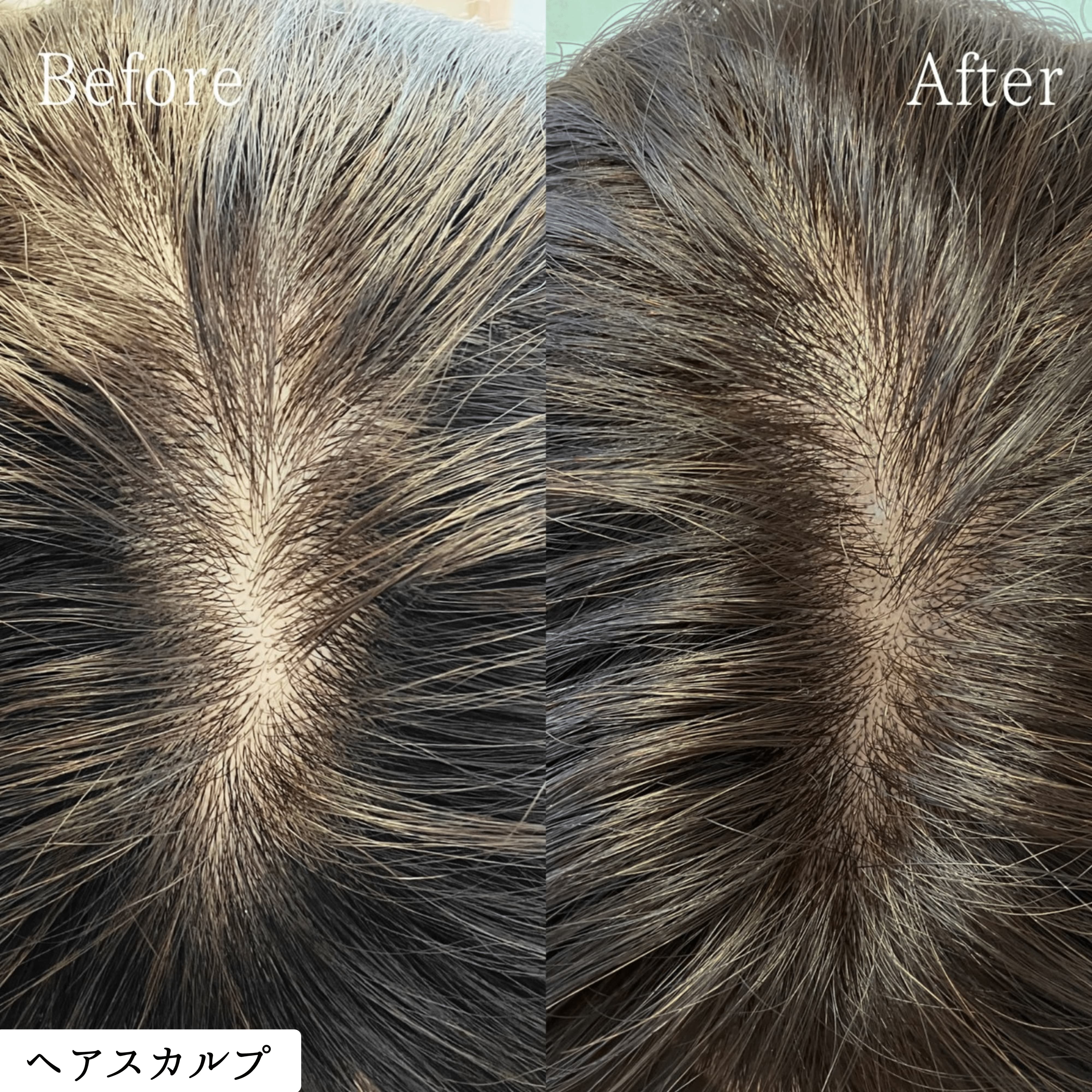 ヘアスカルプメディカルアートメイク 症例 ビフォーアフター｜東京・半蔵門 komi