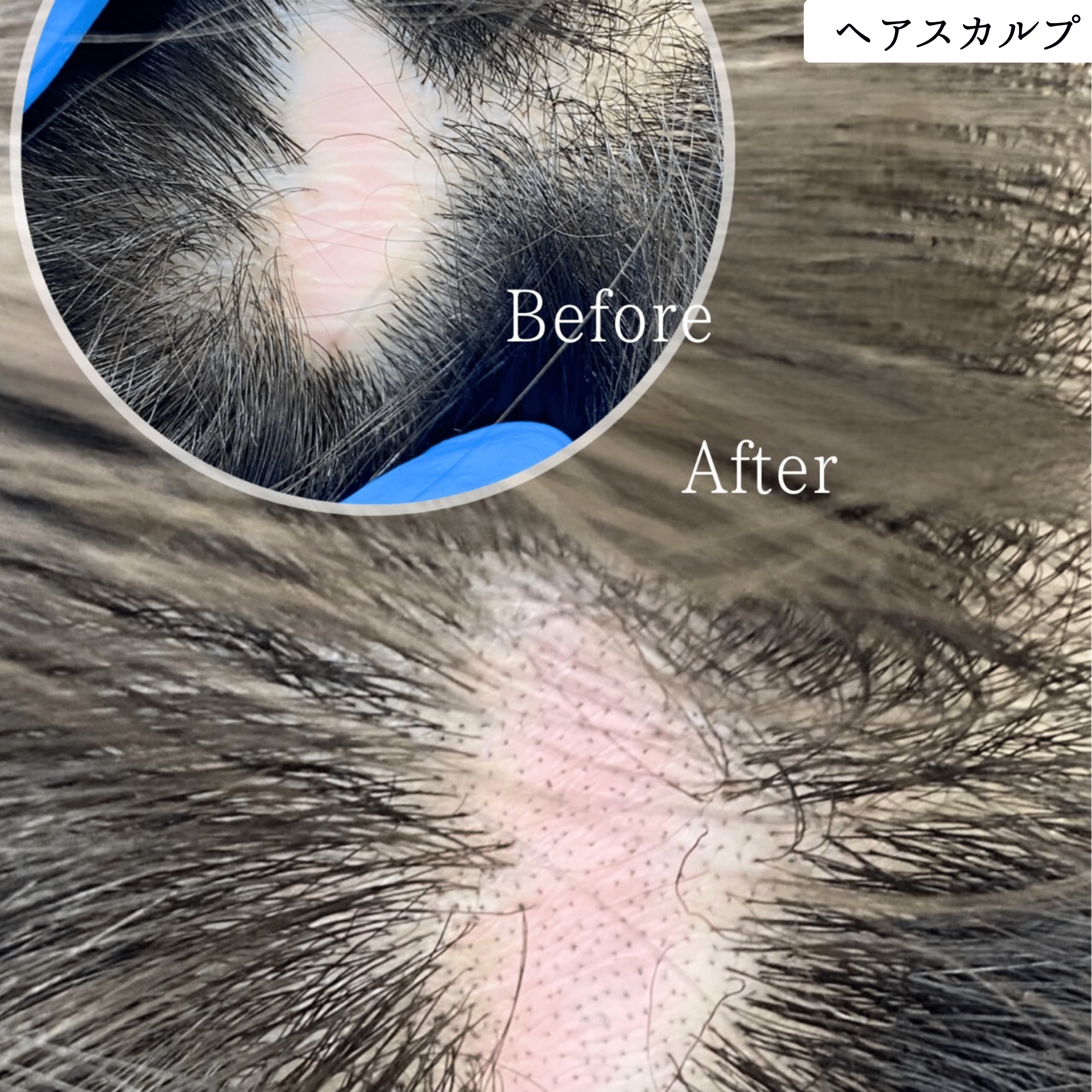 ヘアスカルプメディカルアートメイク 症例 ビフォーアフター｜東京・半蔵門 komi